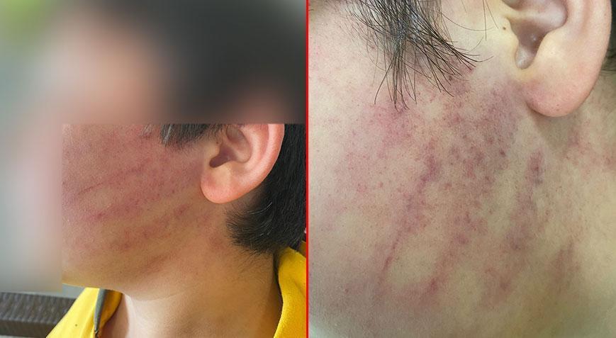 Sınıfta dehşet! Okulda gelen 3 kişilik aile 2 çocuğu hastanelik etti: Panoya kafasını birkaç kere vurmuş