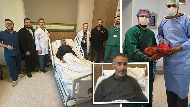 Yıllardır bir bebek gibi karnında taşıyordu! Gaziantep’te 30 dakikada 8 kiloluk böbrek operasyonu